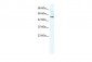 SMPDL3B antibody - N-terminal region